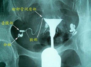 ѹԲ